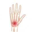 Central Texas Orthobiologics