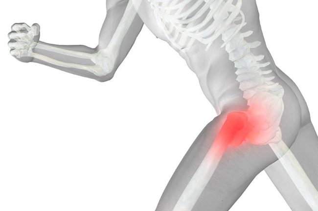 Hip